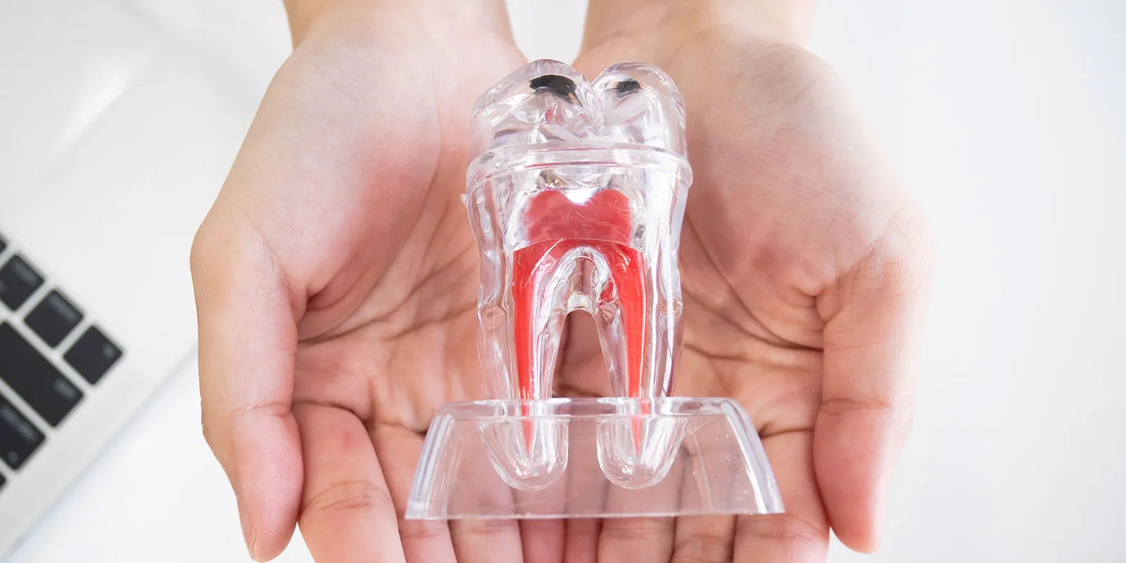 根管治療が必要な症状と