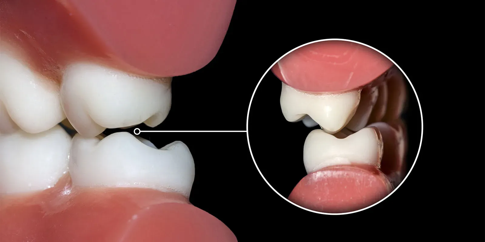 噛み合わせ治療の流れ