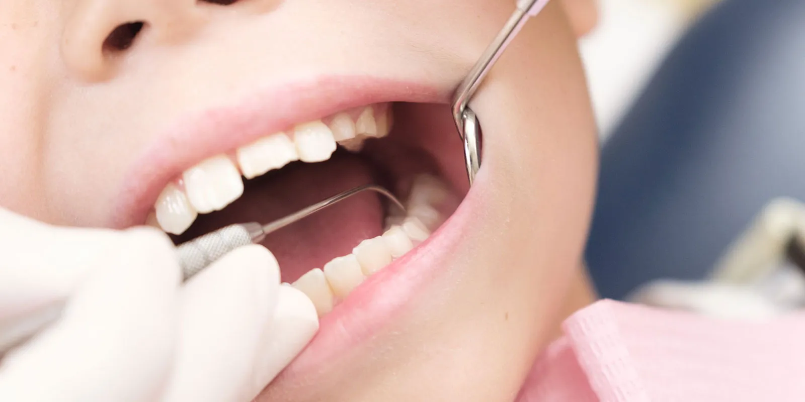 子供の虫歯予防