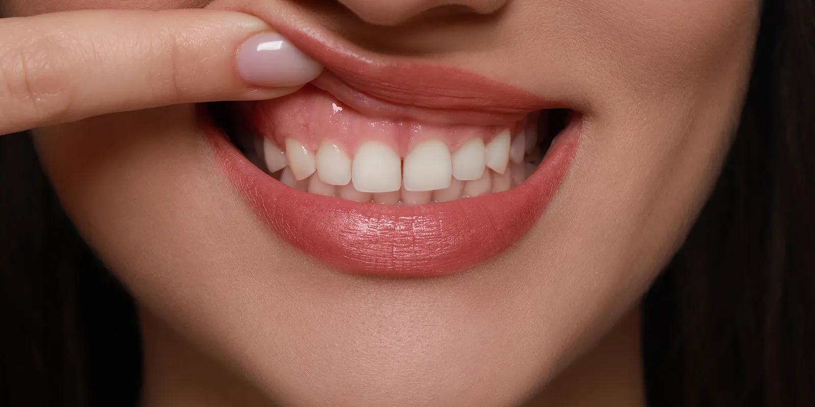 歯周病・歯肉炎について